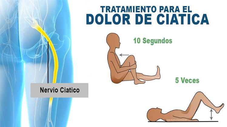 VIDEO: Elimina el Dolor en el Nervio Ciático Rápidamente con Este Increíble Ejercicio